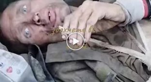 Пленный еле живой последователь Путина рассказывает, как обращаются с солдатами во второй армии мира