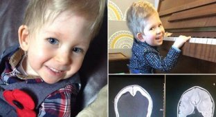 Мальчик, родившийся без мозга, опроверг прогнозы врачей (8 фото)