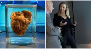 16 years later, a woman saw her heart in a museum (4 photos)