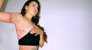 Мария Сантос показала свое изуродованное тело