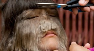 She Was Once Called "The Hairiest Teenager in the World," But Today She Looks Completely Different (5 photos)