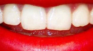 Советы древних стоматологов