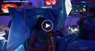 In Italy, a man had a brain tumor removed for 9 hours while he played the saxophone