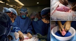 Хирурги успешно пересадили человеку почки свиньи (7 фото + 1 видео)