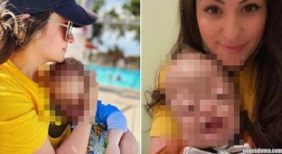 “What a freak!”: Users beg a young mother to stop publishing photos of her son on social networks (6 photos)