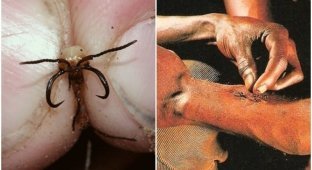 Как муравьёв используют в качестве хирургического шва (7 фото + 1 видео)