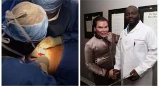 Человек-кукла Родриго Алвес удалил себе 4 ребра в погоне за осиной талией (6 фото + 1 видео)
