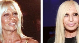Звезды Голливуда до и после пластических операций (54 фото)