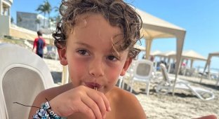 Shocking Moment: Doctor Removes Live Crab from Boy's Ear (4 photos + 1 video)