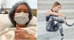 Девушка лишилась обеих ног после того, как почувствовала симптомы гриппа, но не сдалась - и стала спортсменкой (7 фото)