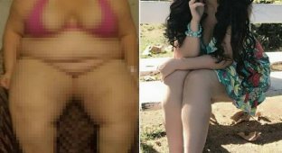Бразильянка избавилась от 88 кг после операции на желудке (15 фото)