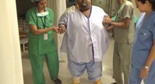 Самый толстый подросток в мире сбросил почти 64 кг после шунтирования желудка и наконец смог ходить (5 фото)