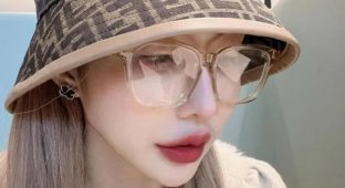 Model after 19 plastic surgery is surprised by what the x-ray of her body at the airport showed (4 photos)