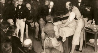 Шокирующие факты о викторианской хирургии (7 фото)