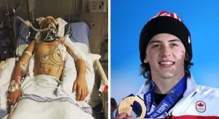 Сноубордист оправился от ужасной аварии, чтобы выиграть олимпийскую медаль (9 фото)