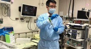 В Тайване гриб пророс в кишечнике пациента (3 фото)