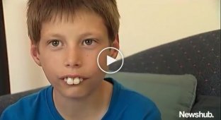 The boy was bullied all the time because of his teeth