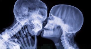 14 неожиданных фотографий: люди в рентгеновских лучах (15 фото)