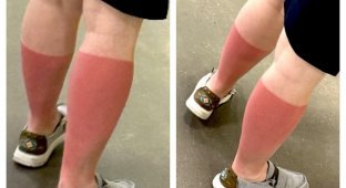 Toasted: a selection of funny and disastrous tan (15 photos)