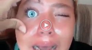 11-летняя жительница Бразилии пожалела, что вставила себе под веко кукольный глаз