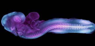 Вчені вперше відобразили процес формування ембріона на ранній стадії розвитку (6 фото + 1 відео)
