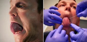 Втомився від непристойних жартів: як живе чоловік із найбільшою у світі язиком (3 фото + 1 відео)