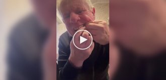 Британець вирвав собі зуб за допомогою гантелі і шнурка