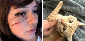 Dangerous claws: a cat almost deprived its owner of sight (2 photos + 1 video)