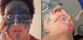 Женщина сводит с лица насильно нанесённые татуировки (4 фото + 1 видео)