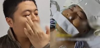 He loved to pick his nose and paid the price: the man underwent emergency surgery (2 photos)