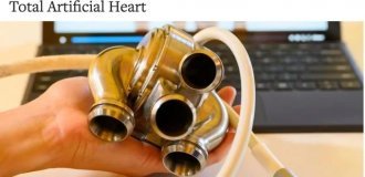 The first real cyborg: in Texas, a mechanical heart was successfully implanted into a person for the first time (3 photos)