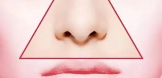 У девушки перекосило лицо от выдавленного прыща (4 фото)