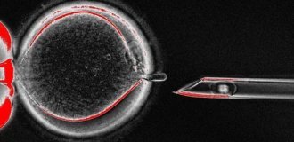Scientists have created human eggs from skin cells (3 photos)