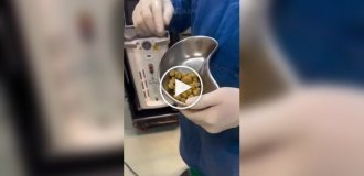 Что будет, если пить 2-3 литра колы в день