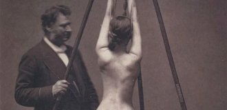 18 одновременно пугающих и завораживающих фотографий медицины прошлого (19 фото)