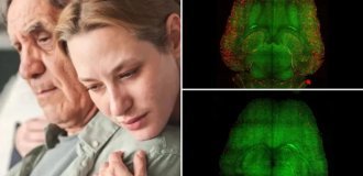 Нанотехнологии показали эффективность в лечении болезни Альцгеймера у мышей (3 фото)