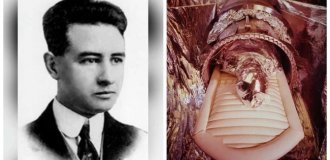 Джеймс Бедфорд: вечный пациент в ожидании будущего (9 фото)