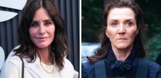 Who Looks Better: Celebrities of the Same Age With and Without Plastic Surgery (15 photos)