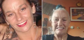 Женщина отдала все деньги на новые зубы и "постарела на 20 лет" за один день (4 фото)