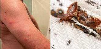 Bedbugs bit a pilot in a hotel, but the administrator sided with the bloodsuckers (4 photos + 1 video)