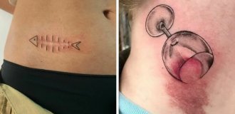 16 гениальных татуировок, которые помогли людям избавиться от шрамов и родимых пятен (17 фото)