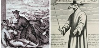 Harsh Medieval Medicine: Bloodletting, Prayer Healing, and Fighting Epidemics (8 photos)