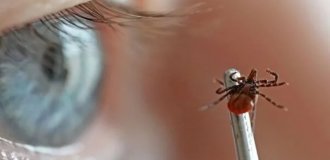 Summer Safety Guide: Infections You Can Catch from Bugs on a Casual Walk (6 photos)