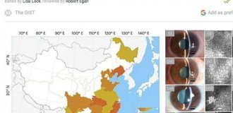 Сообщения о «новом вирусе» у любителей суши (фото)