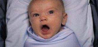 Why is circumcision so popular in the US? And it's not about hygiene or religion (6 photos)