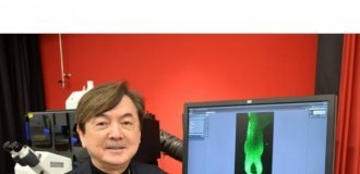 "20 лет исследований прошли не зря": ученые из Японии победили облысение (фото)