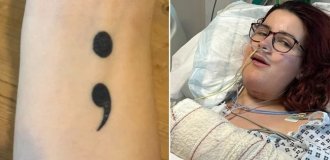 After surgery, a girl discovered a tattoo on her left hand, on her tongue (5 photos)