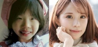 From "ugly" to a star of social networks: a Japanese blogger spent $170,000 on plastic surgery (8 photos + 1 video)