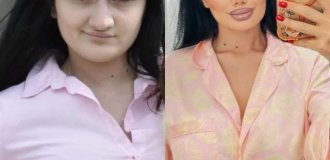 Two different people: This girl's upgrade has gone viral — online debates are raging over whether plastic surgery made her more beautiful (3 photos)