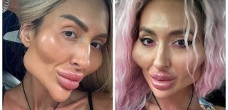 Ukrainian woman with “the world’s biggest cheeks” showed what she looked like before (4 photos + 1 video)